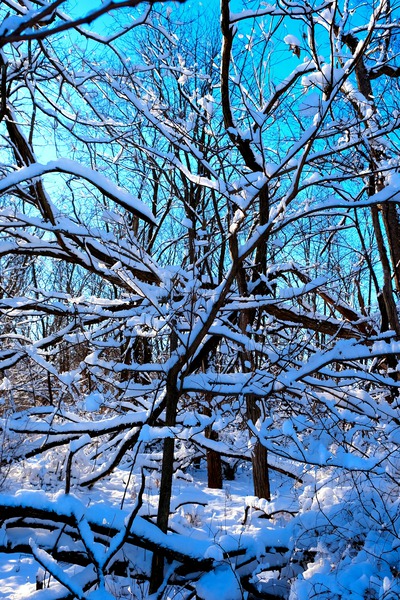 Frozen Limbs 3B Print
